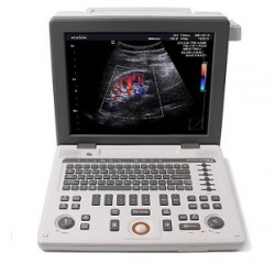 Ultrasonido Doppler color 3D modelo Sonoace transductor lineal paq. B - Envío Gratuito